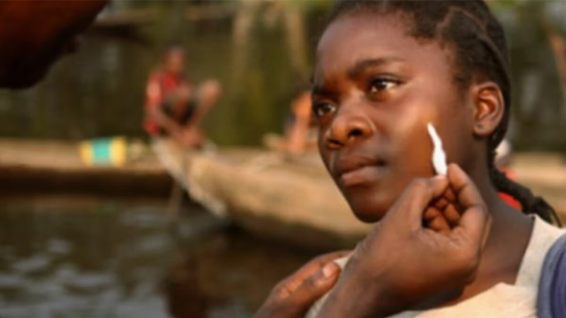 Beat Leprosy. End Stigma.