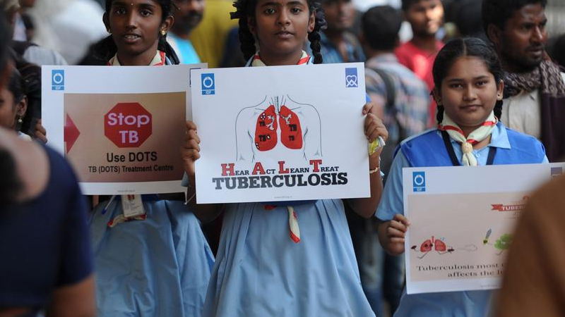 Eradicating Tuberculosis